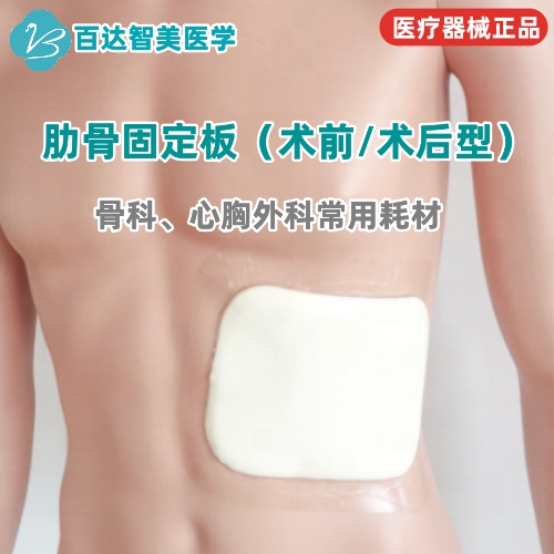 1738913447498031.jpg 肋骨固定板99_副本.jpg